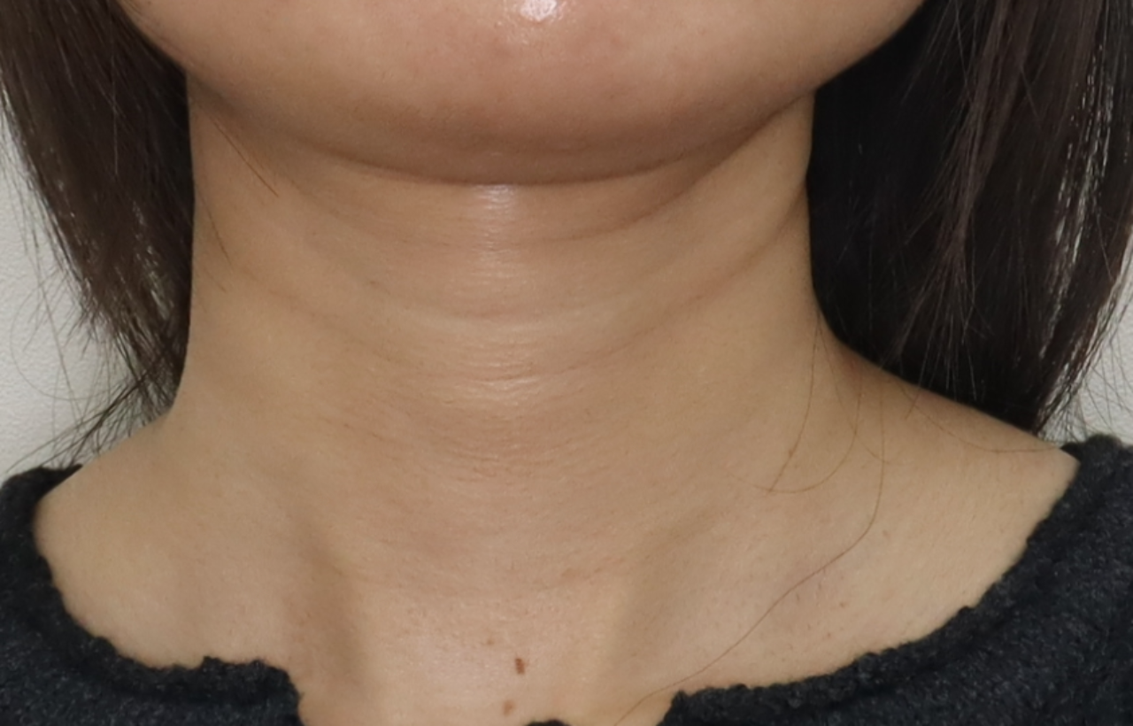 Allure Plastic Surgery 案例