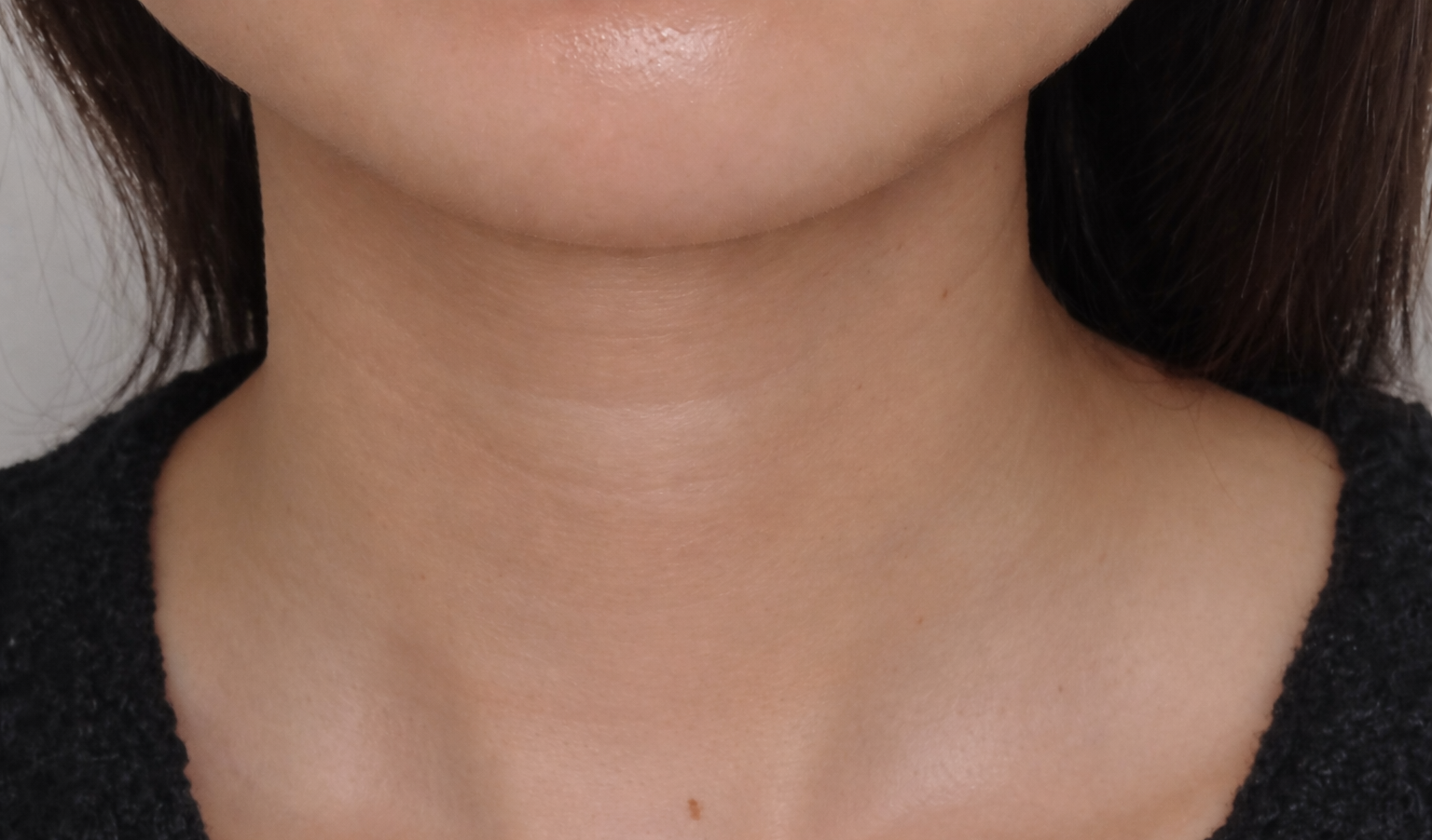 Allure Plastic Surgery 案例