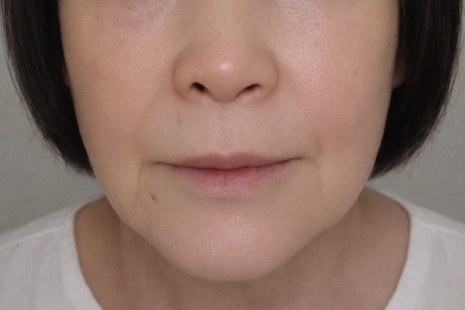 Allure Plastic Surgery 案例