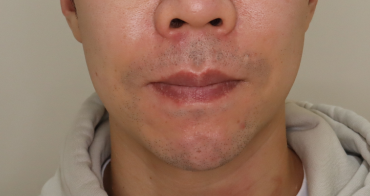Allure Plastic Surgery 案例