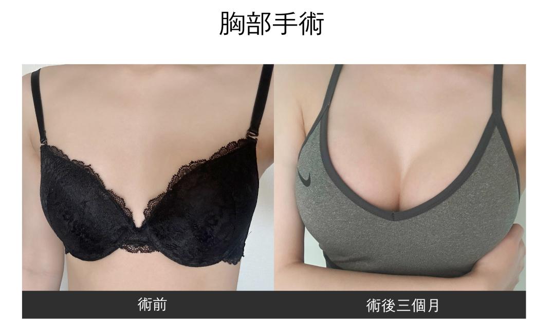 renovo 案例
