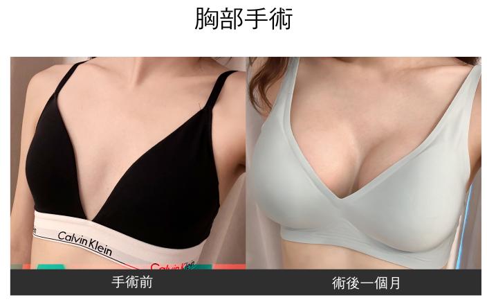 renovo 案例