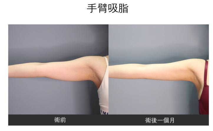 renovo 案例