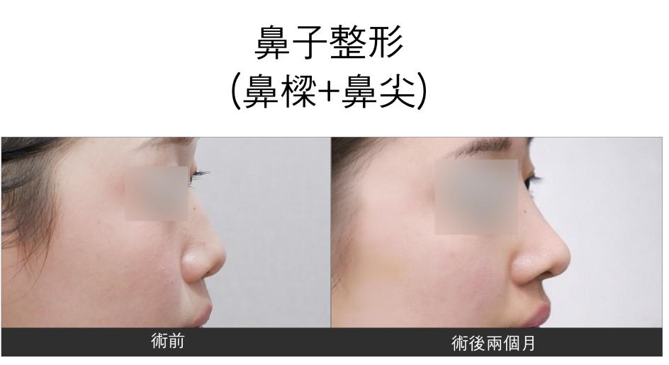 renovo 案例