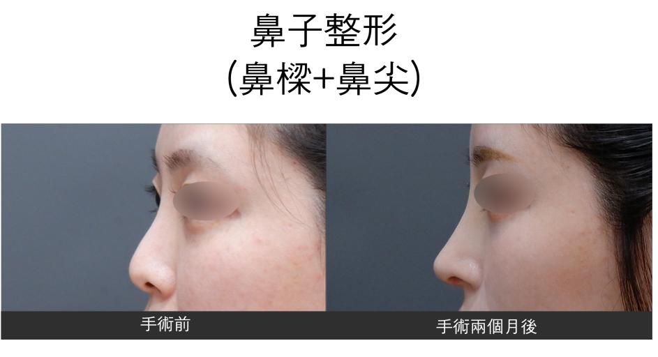 renovo 案例