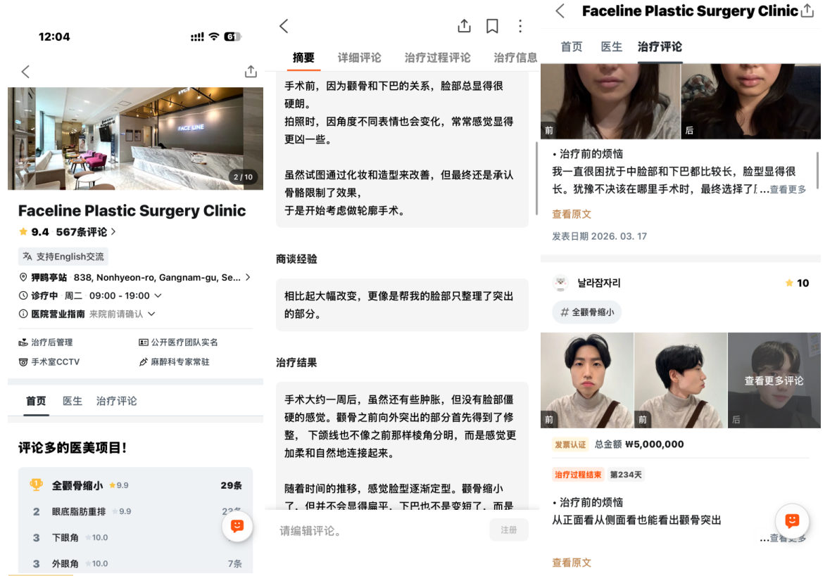 韩国医院本地评价&评分汇总——Face line整形外科
