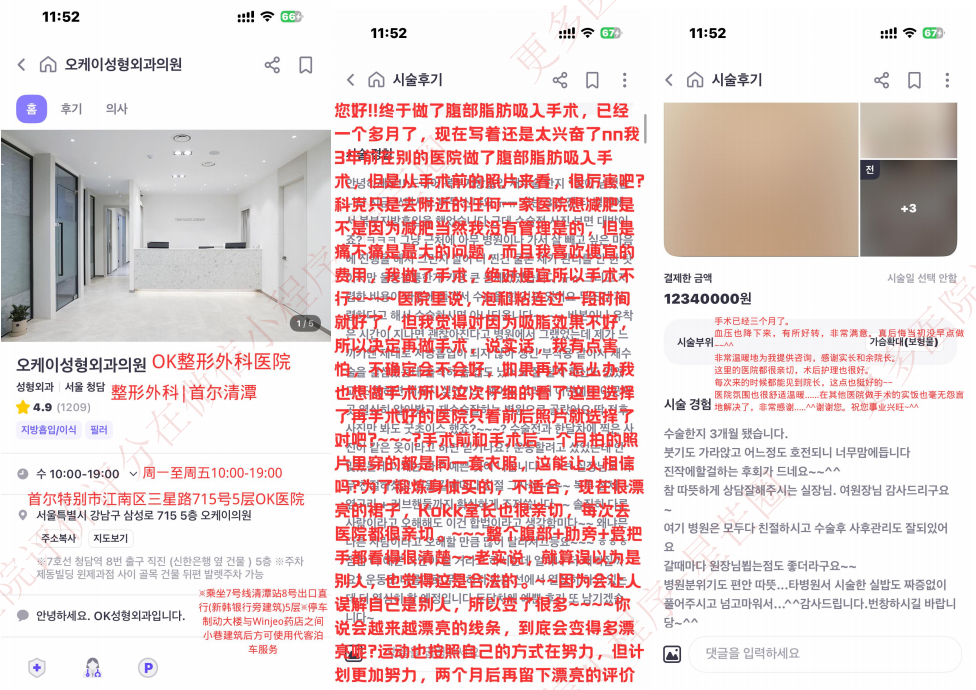 韩国医院本地评价&评分汇总——清潭 okay 整形外科