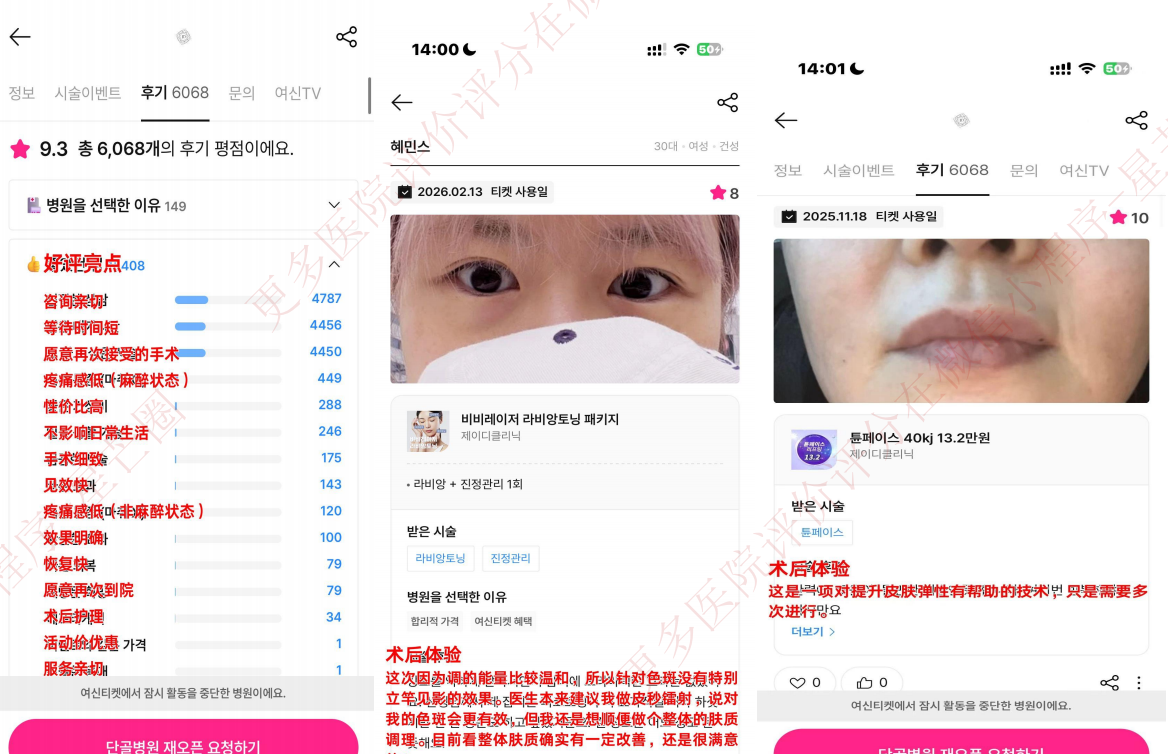 韩国医院本地评价&评分汇总——JD 皮肤科 （江南）