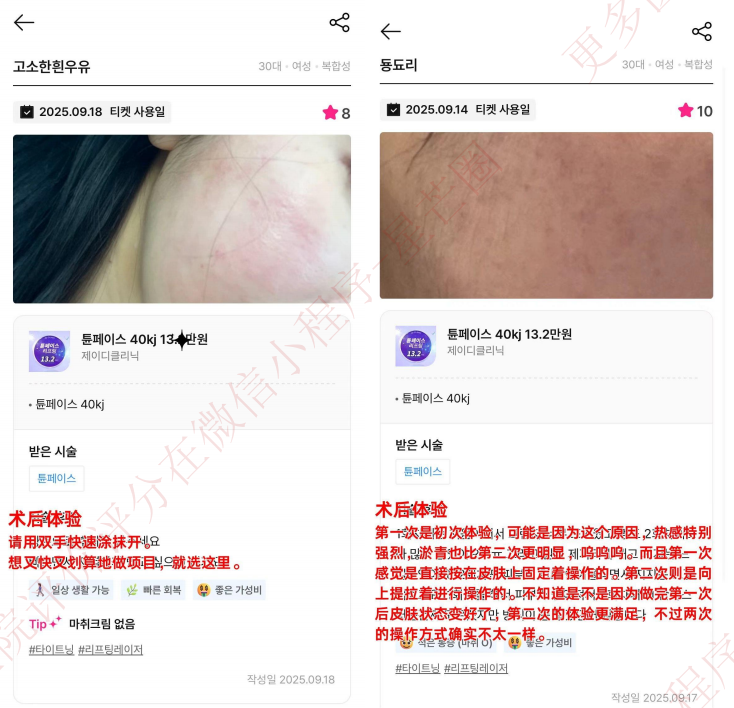 韩国医院本地评价&评分汇总——JD 皮肤科 （江南）