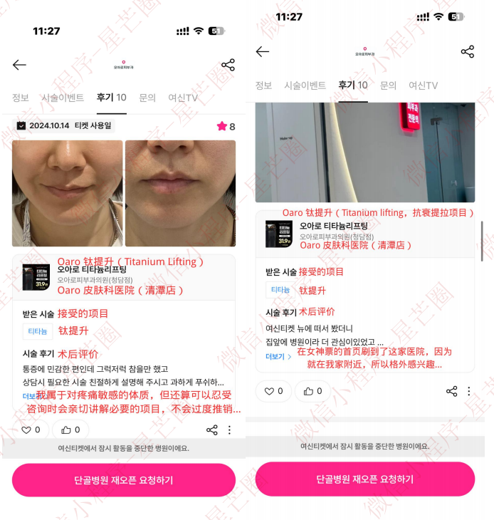 韩国医院本地评价&评分汇总——清潭 oaro 皮肤科