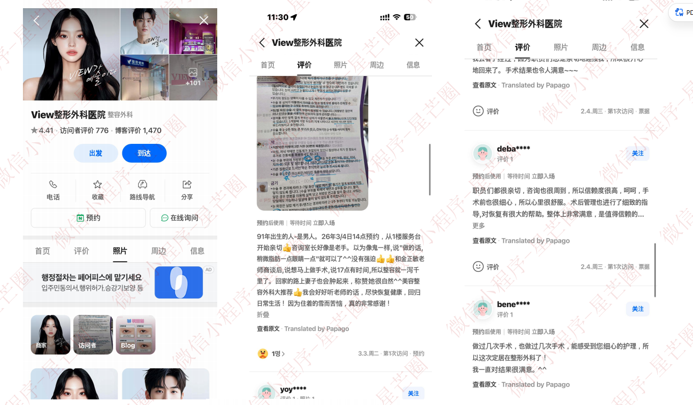 韩国医院本地评价&评分汇总——View（biwu）整形外科