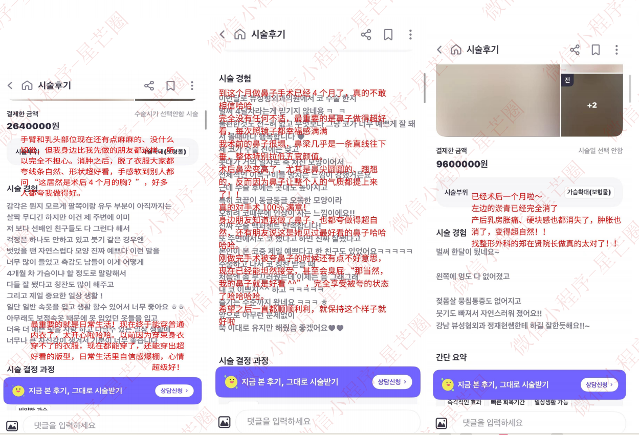 韩国医院本地评价&评分汇总——View（biwu）整形外科