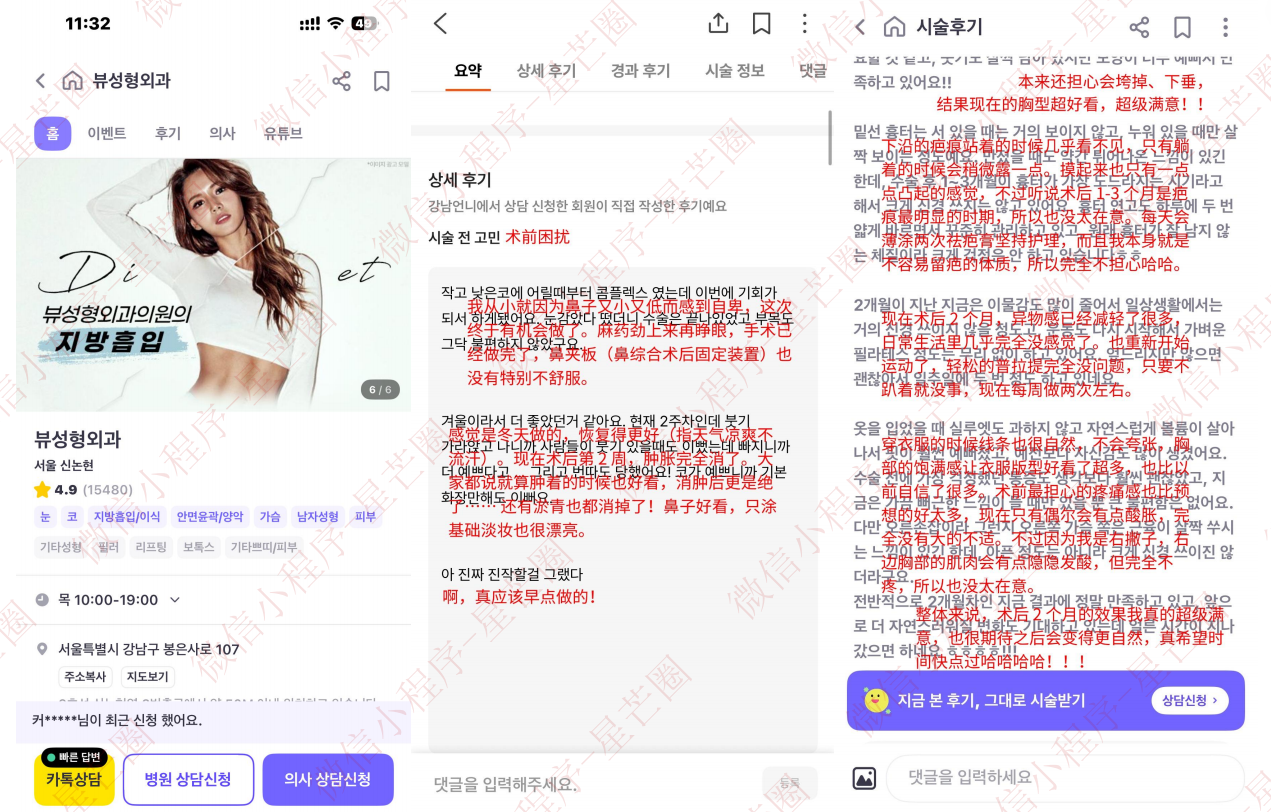 韩国医院本地评价&评分汇总——View（biwu）整形外科