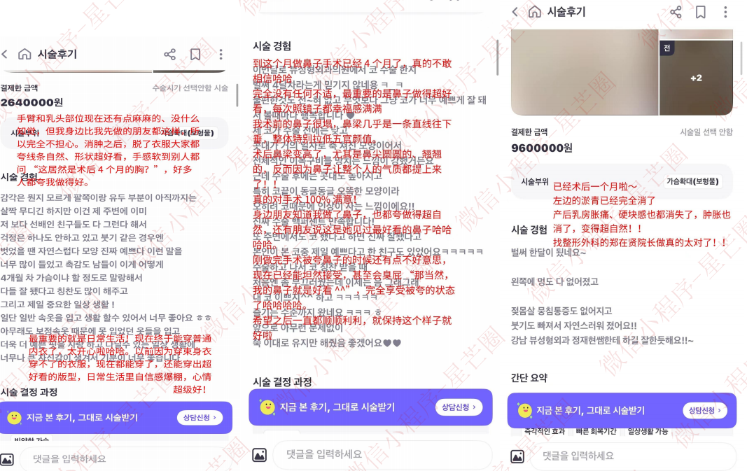 韩国医院本地评价&评分汇总——View（biwu）整形外科