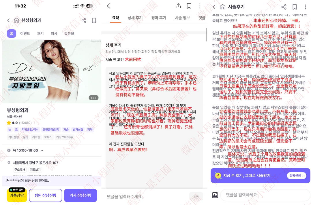 韩国医院本地评价&评分汇总——View(biwu)整形外科