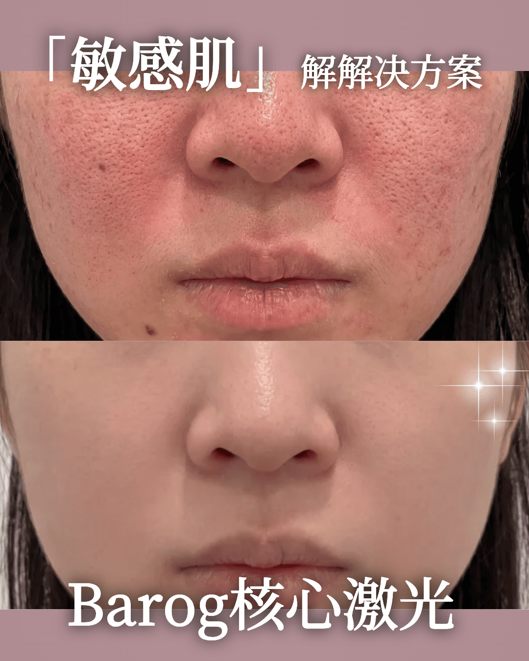 barogclinic Gangnam 案例