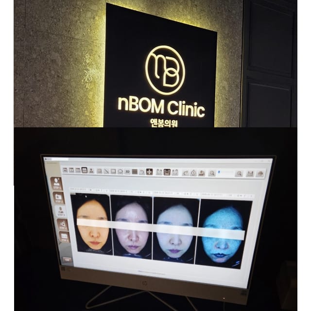 nbom皮肤科