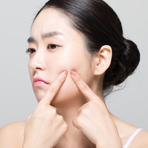 Treatment for Acne and Skin Problems