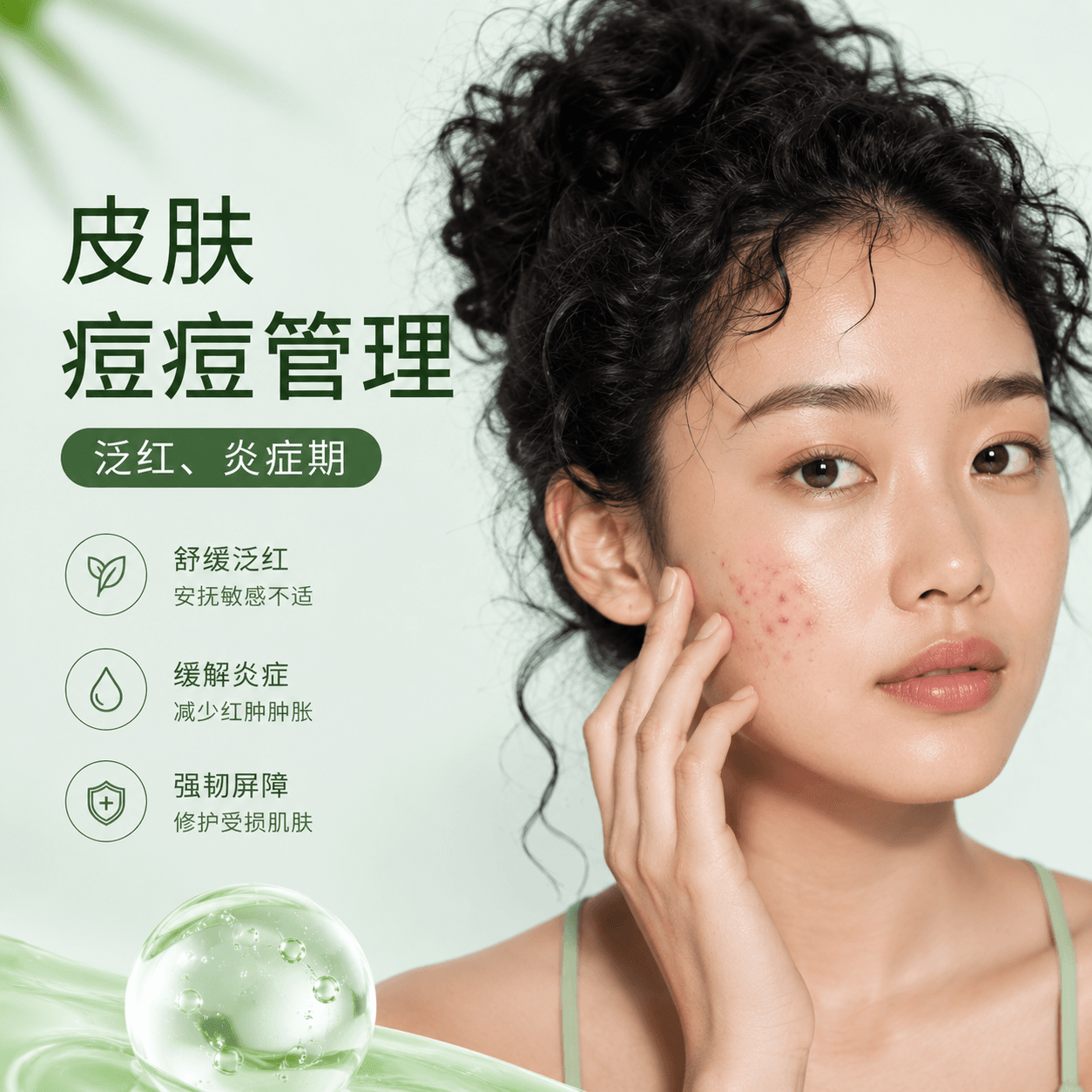 高端痘痘管理套餐 (修丽可痘痘护理 / LDM 痘痘模式 12分钟 + 痘痘针清 + Potenza 黄金微针痘痘模式全脸)