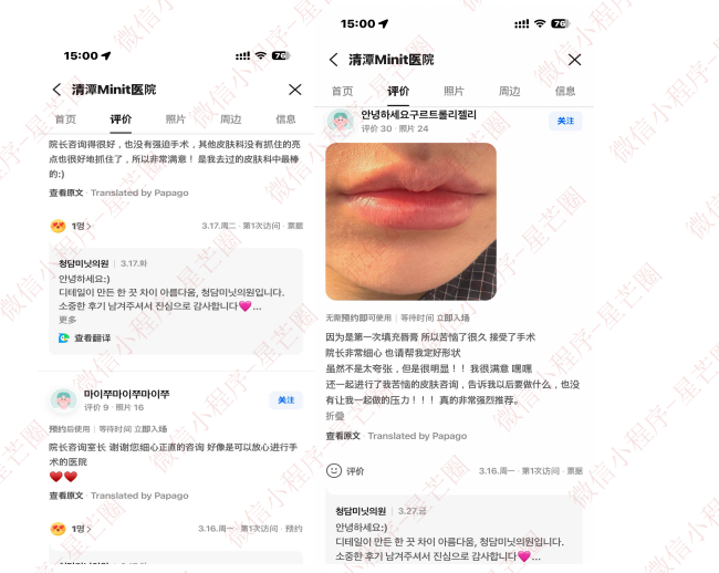 韩国医院本地评价&评分汇总——清潭 mint 皮肤科