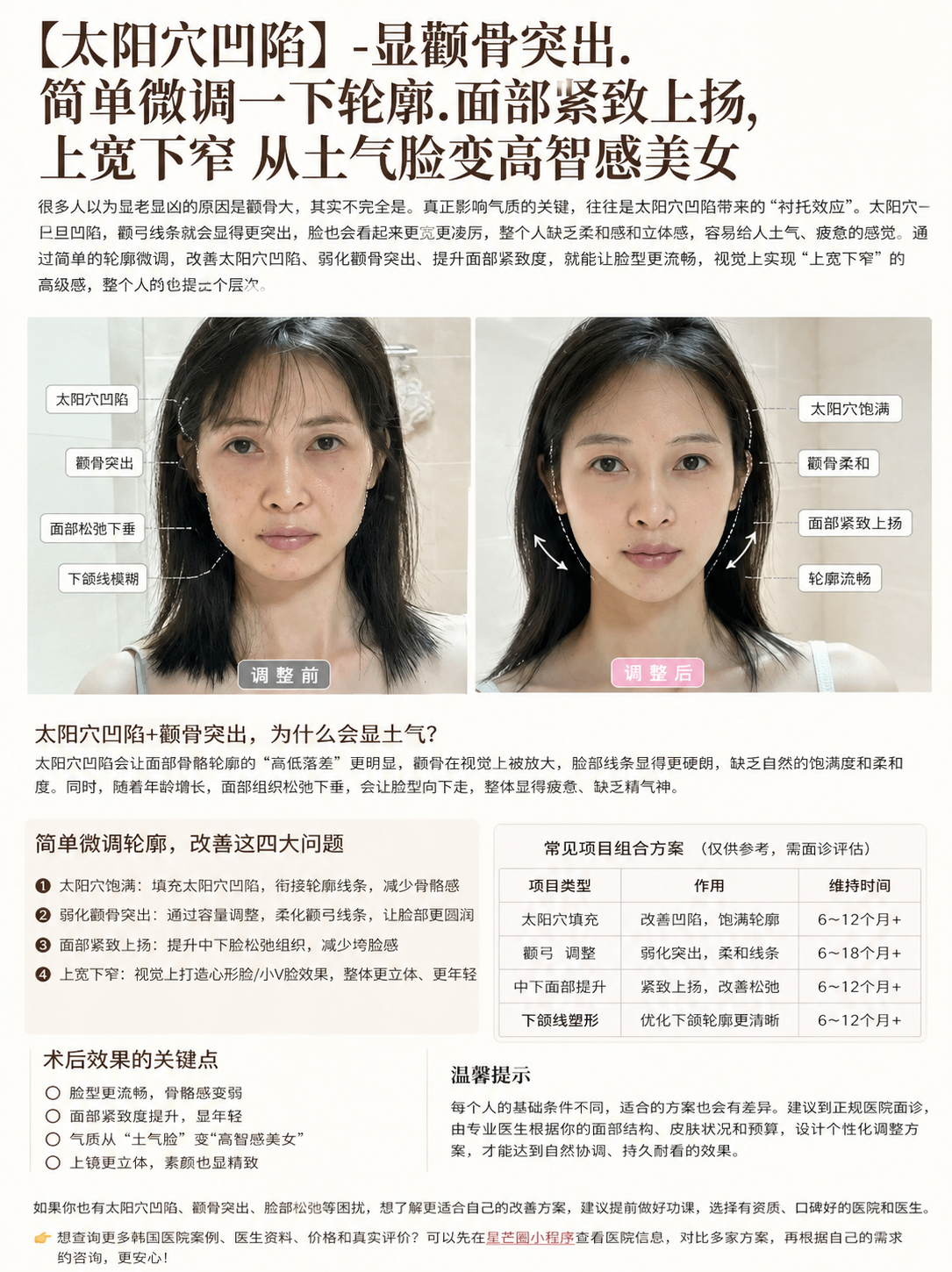 太阳穴凹陷有多影响颜值？很多人显土气，其实问题不在颧骨