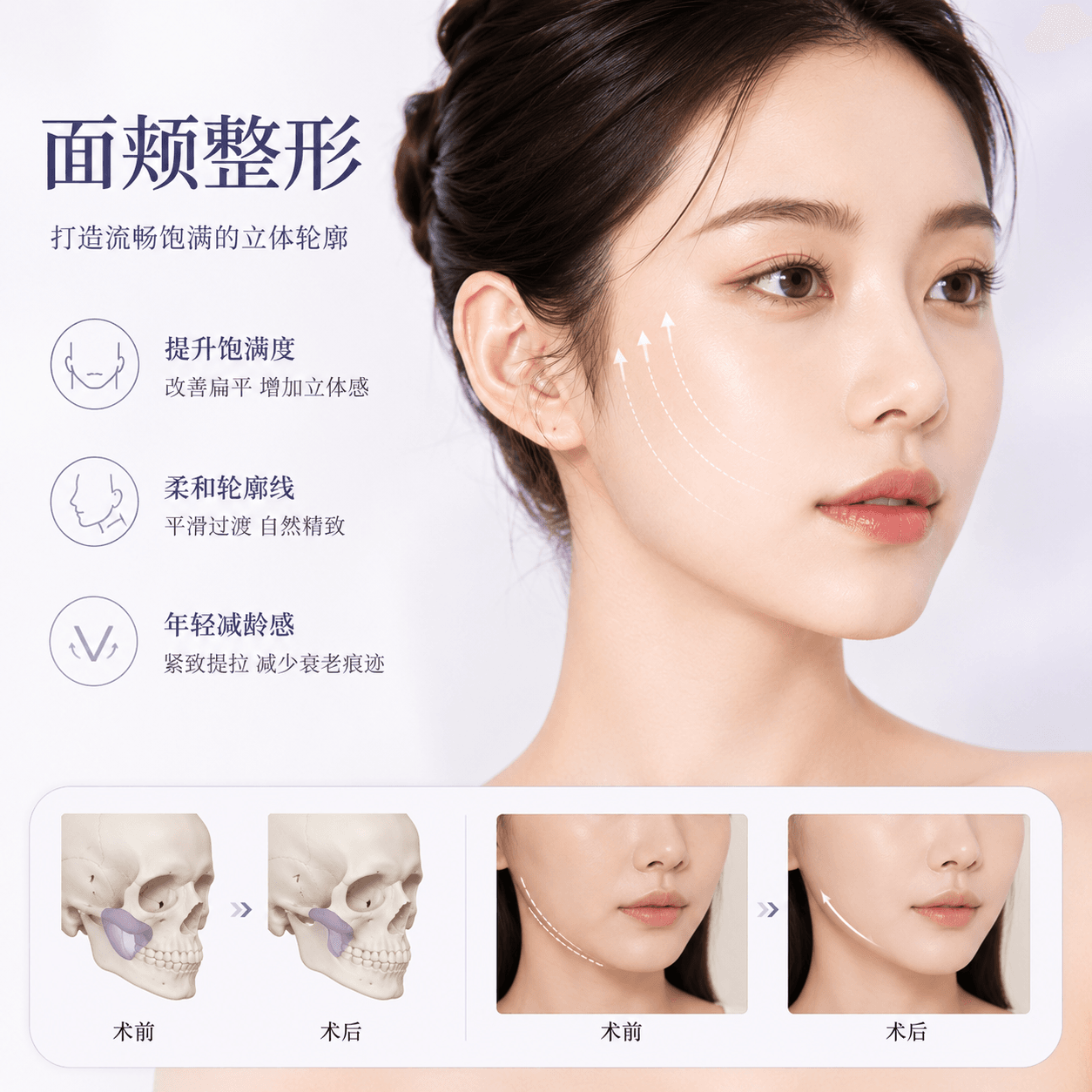 两颊玻尿酸