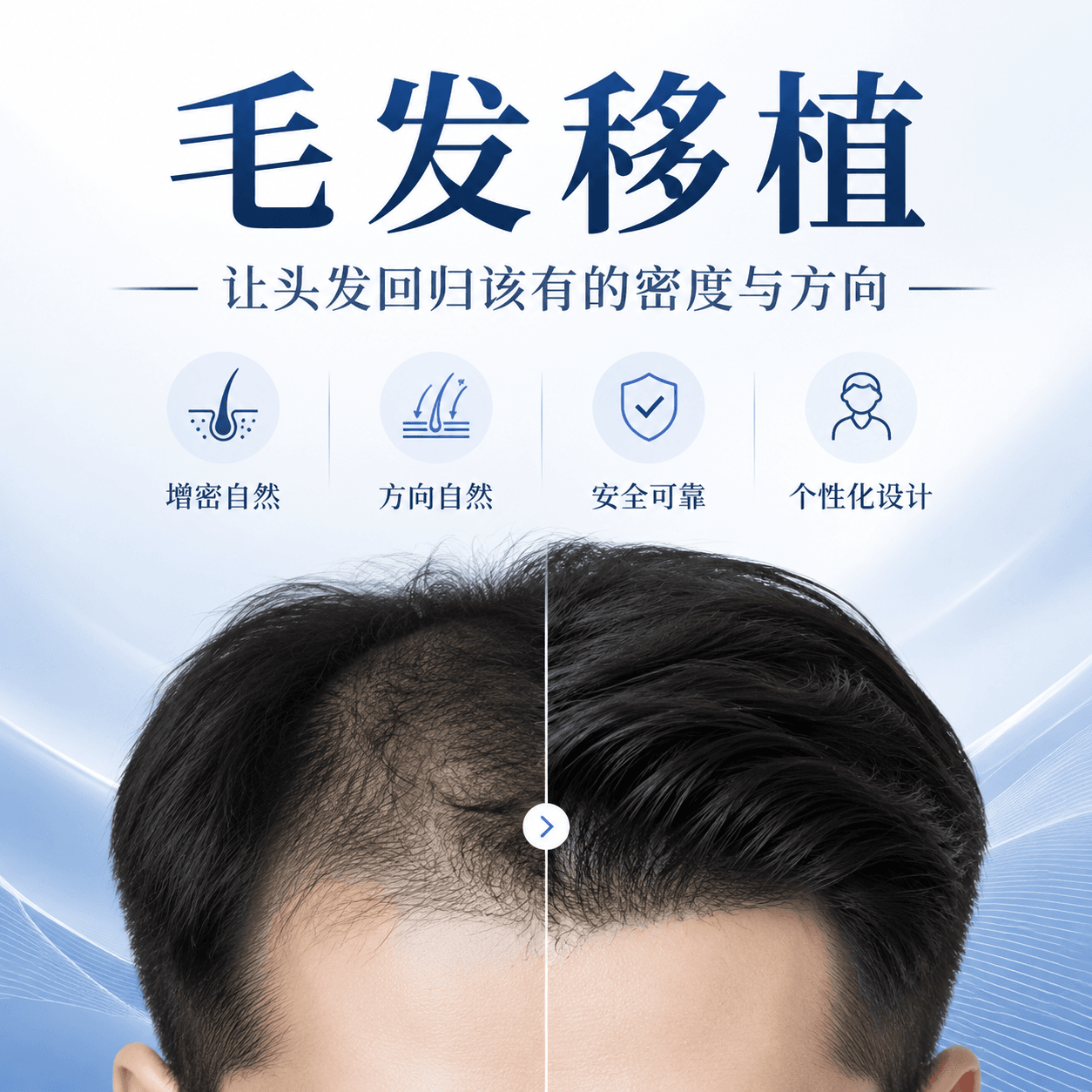 头顶
