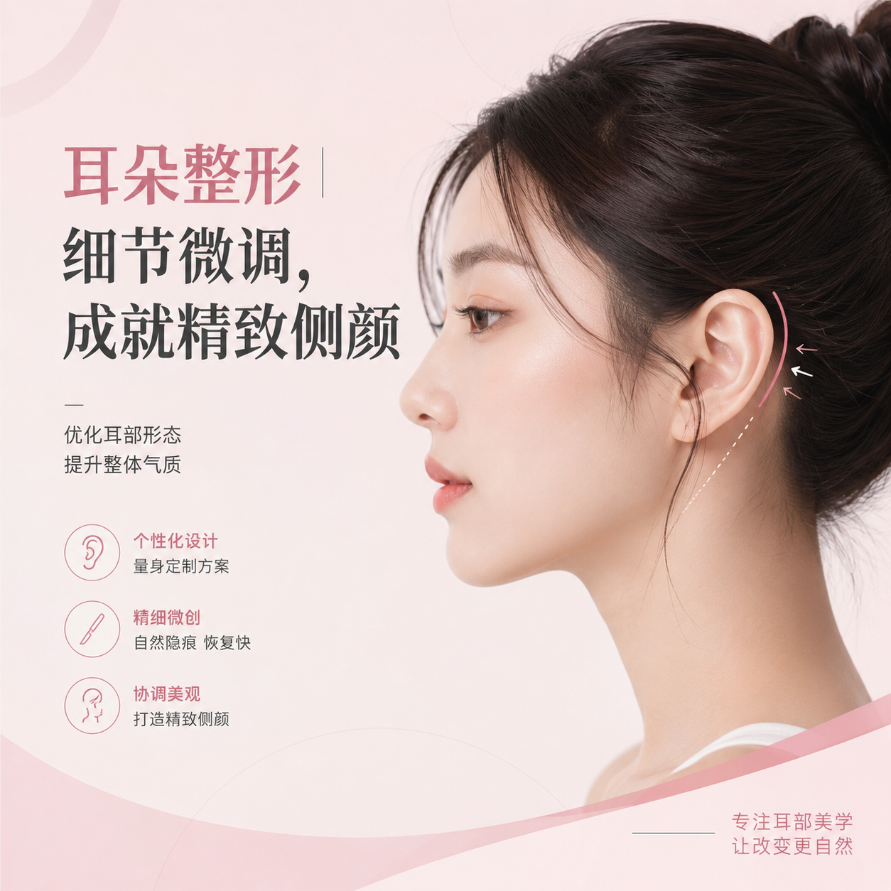 贴面耳·耳垂·耳轮玻尿酸填充