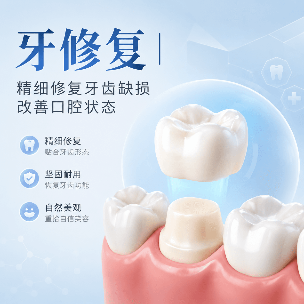 CEREC 嵌体
