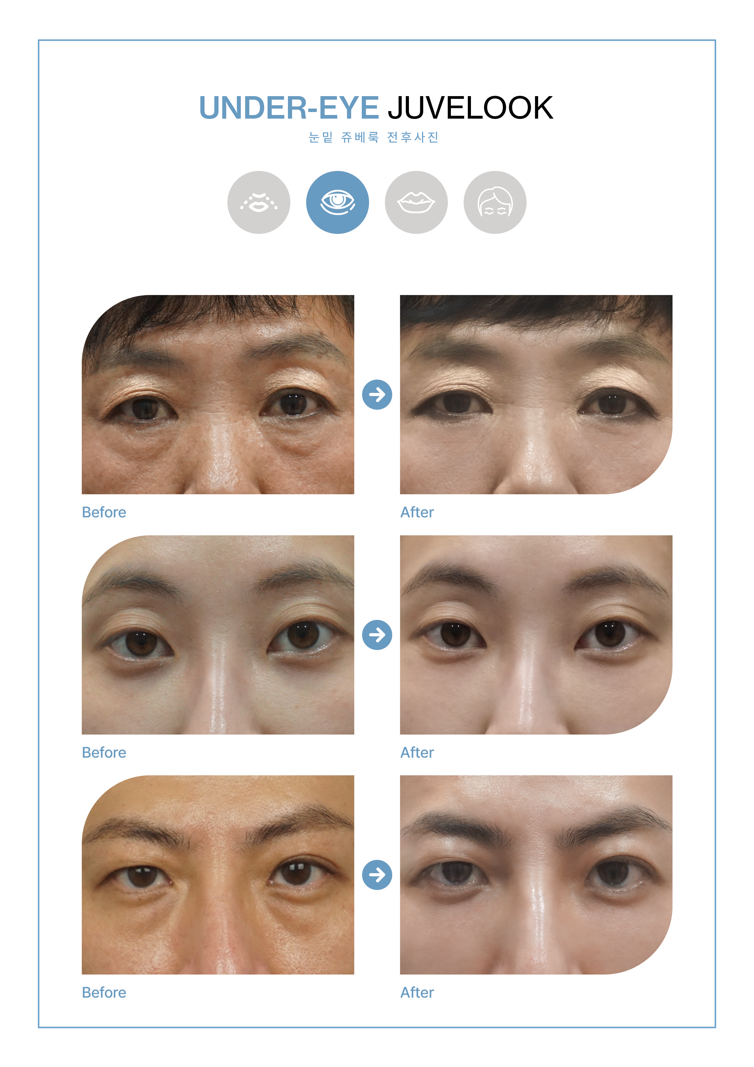 VSLINE CLINIC GANGNAM 案例