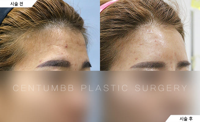 CENTUMBB PLASTIC SURGERY & DERMATOLOGY 案例