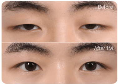 wonderfulps 案例