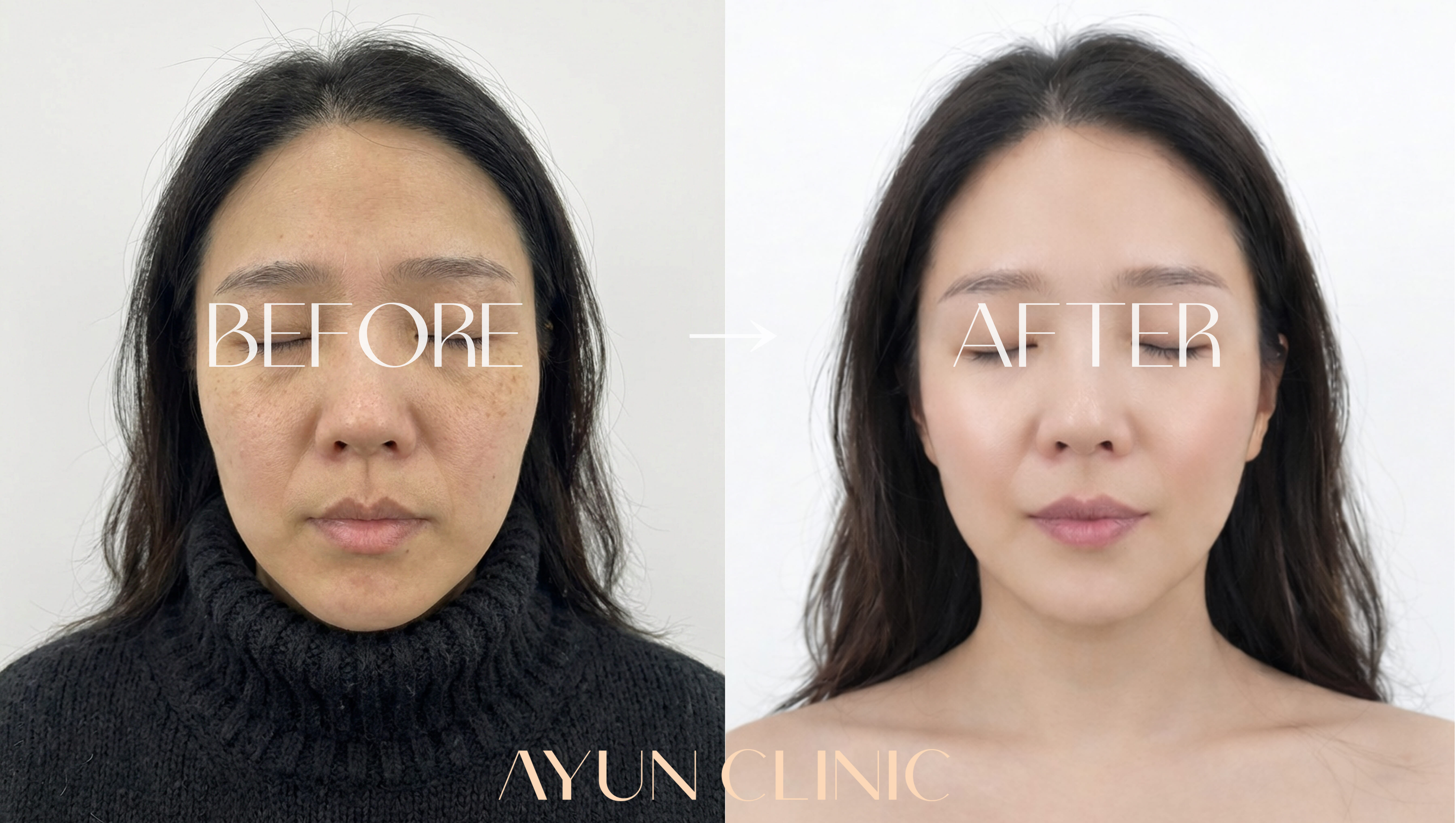 AYUN CLINIC 案例