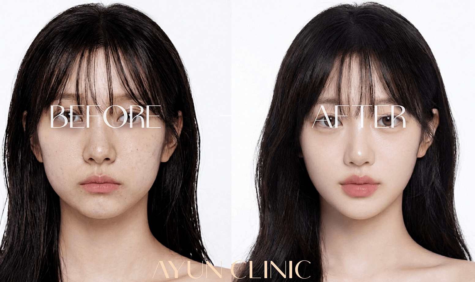 AYUN CLINIC 案例