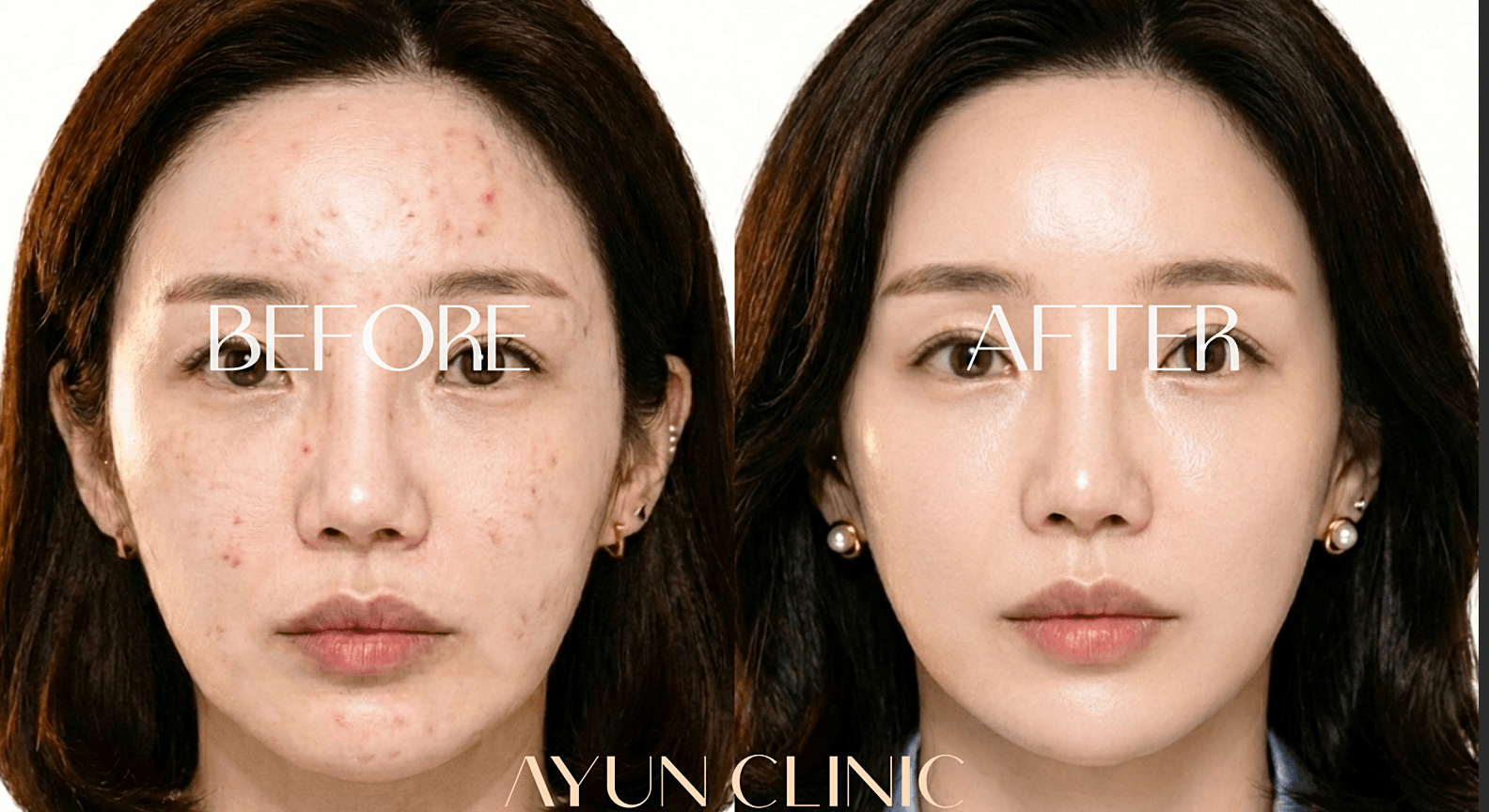 AYUN CLINIC 案例