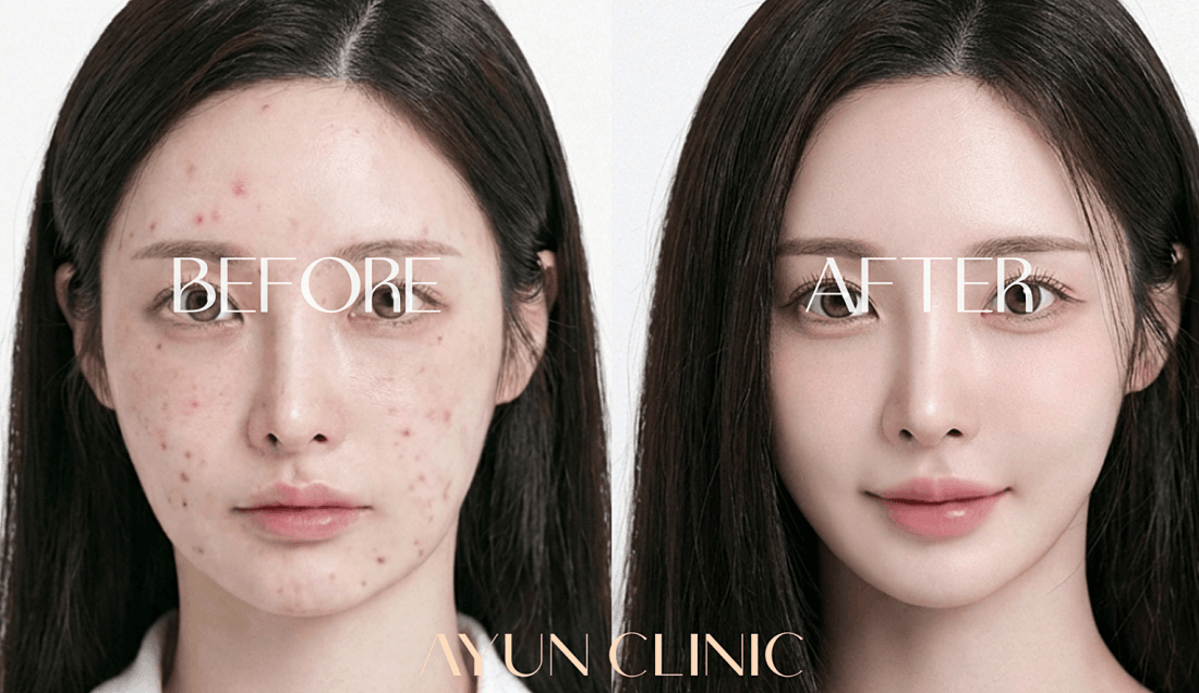 AYUN CLINIC 案例