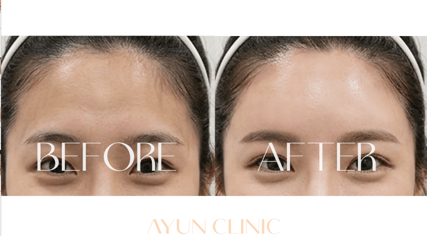 AYUN CLINIC 案例
