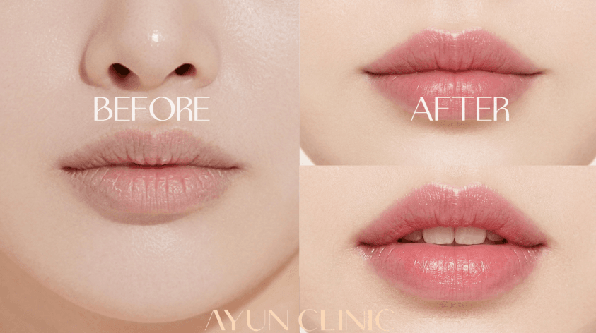 AYUN CLINIC 案例