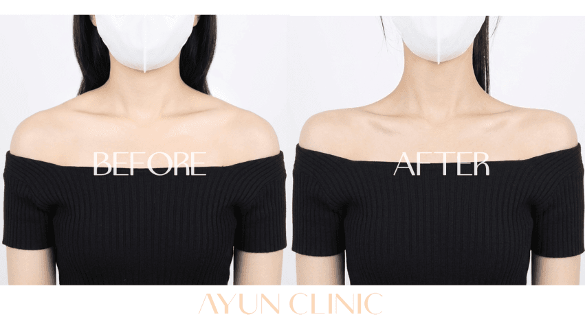 AYUN CLINIC 案例